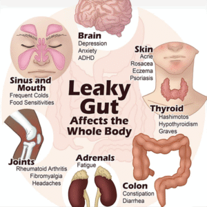 Leaky Gut