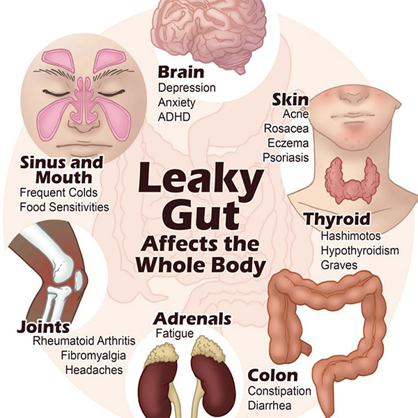 Leaky Gut Protocol