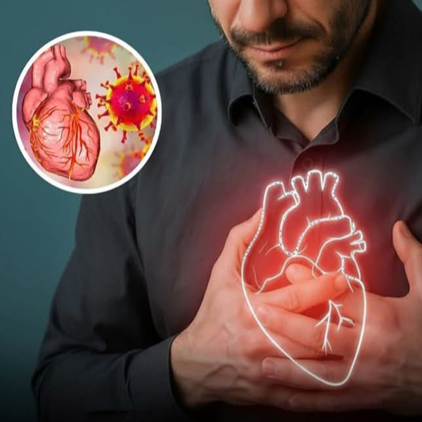 Myocarditis and POTS Natural Remedies